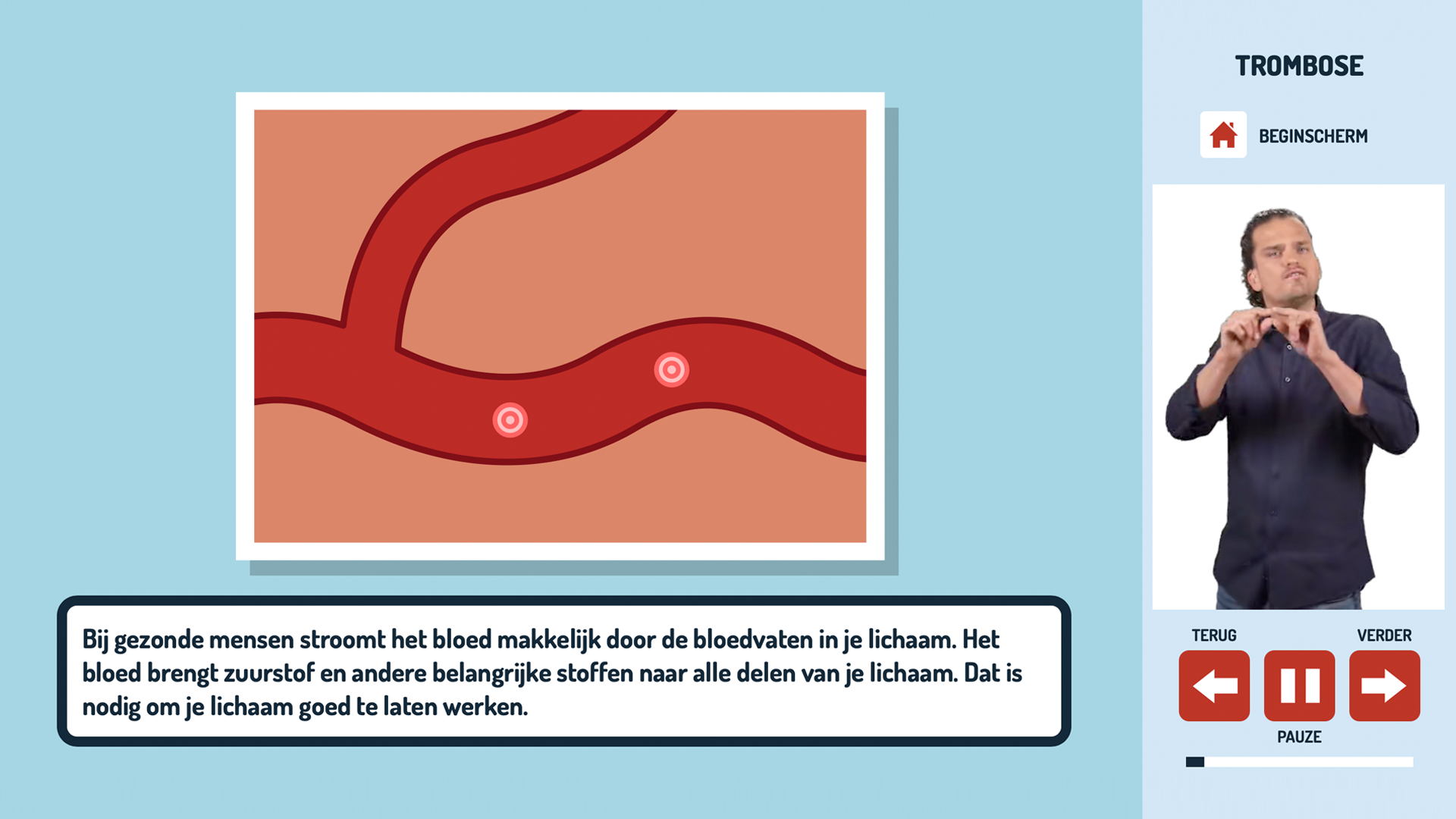 Uitleg over trombose in gebarentaal. Uitleg over trombose in gebarentaal.